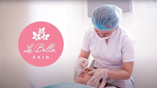 La Bella Skin Commercial
