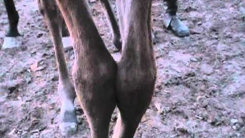 Contracted tendons and ALD, 6 days old