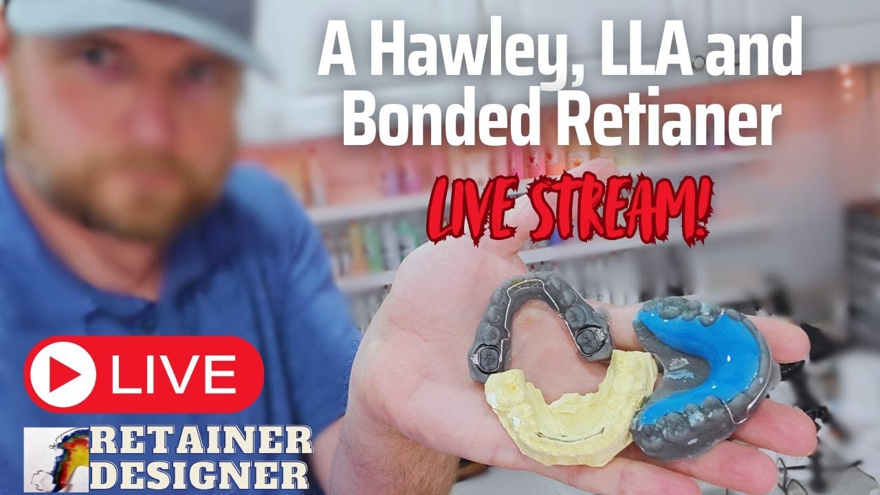 A Hawley, LLA, and Bonded Retainer Live Stream!