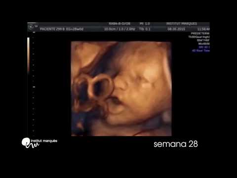 INSTITUT MARQUÈS - Response of the fetus to intravaginal music