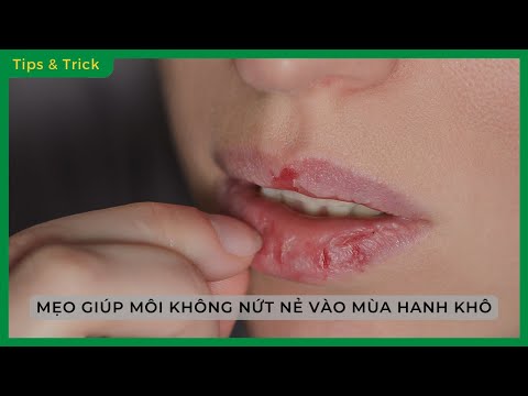 Video: 3 cách để thoát khỏi ngứa da đầu