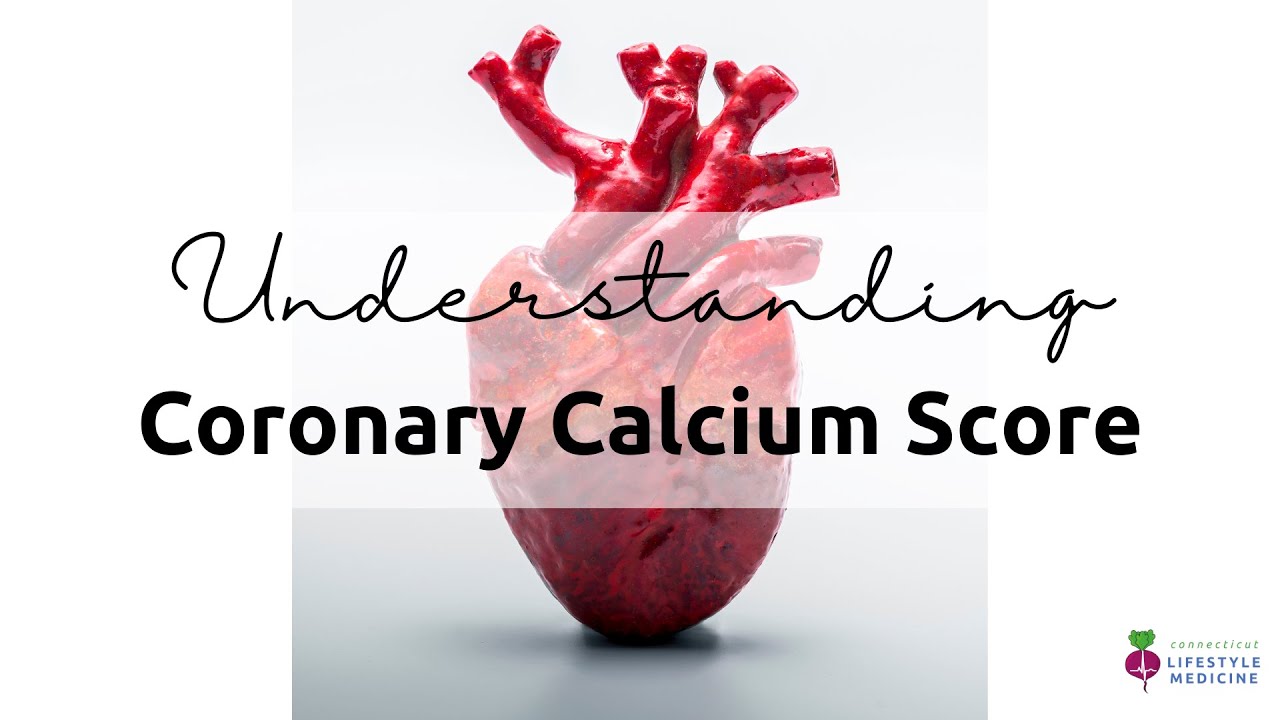 Understanding the Coronary Calcium Score