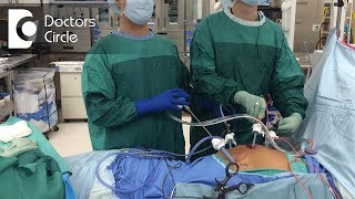 Do's & Dont's after Gynaecologic Laparoscopic Surgeries - Dr. Shafalika Boriah