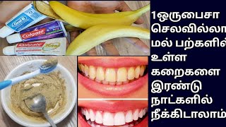 Natural way to whitenteeth at home/tips video/how to whiten/cleaning tips in Tamil@royaltamilkitchen