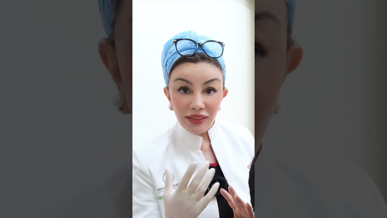 𝐇𝐚𝐢𝐫 𝐓𝐫𝐚𝐧𝐬𝐩𝐥𝐚𝐧𝐭 𝐌𝐚𝐥𝐚𝐲𝐬𝐢𝐚 | 8 месяцев после полного бритья FUE — потрясающее преображение! 