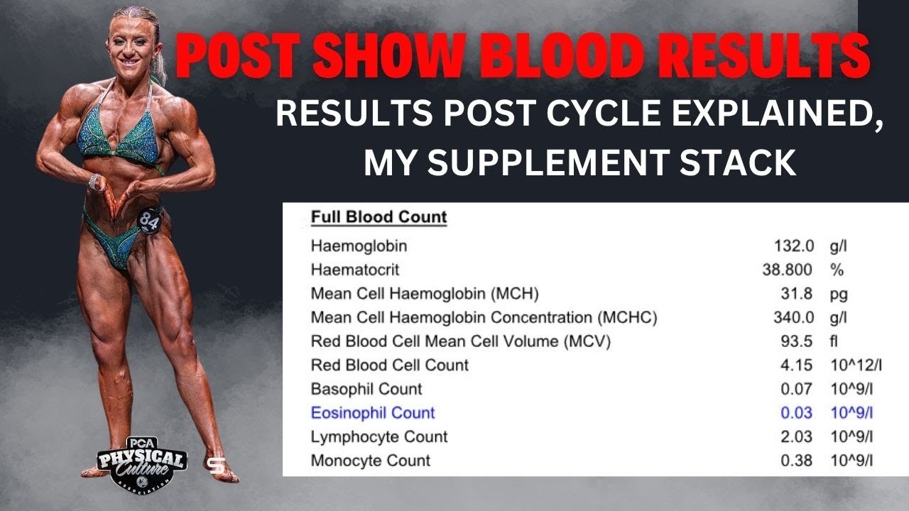 Post-Bodybuilding Prep Blood Results: Anavar, Side Effects & Recovery
