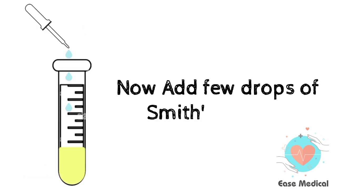 Urine Practical ! Test for bile Pigments.. ! Smith's Test.. ! 