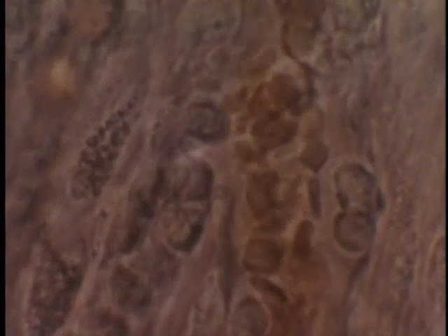 生命のかたち Life and Blood Vessels - YouTube