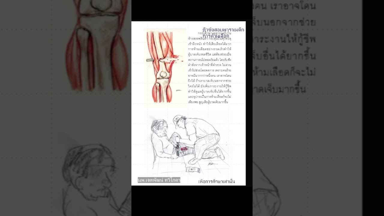 ติวสอบห้ามเลือด