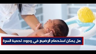 هل يمكن استحمام الرضيع مع وجود لحمية السرة الورم الحبيبي