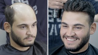 PROTEZ SAÇ - DAĞALLIKTA ÖNCÜYÜZ! - Hair Replacement Resimi