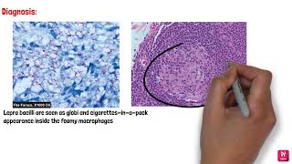 BACTERIAL INFECTIONS OF ORAL CAVITY