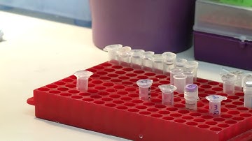 DNA restriction digest