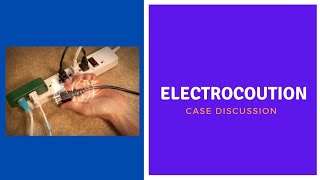 Case Discussion || Electrocution