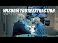 Behind scenes  wisdom tooth extraction