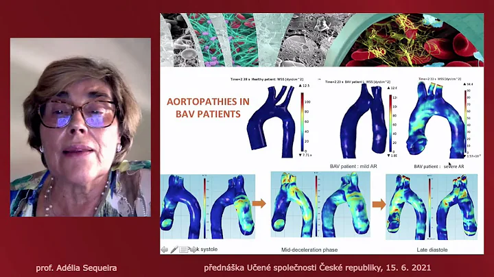 Adlia Sequeira: Cardiovascular mathematics with ap...