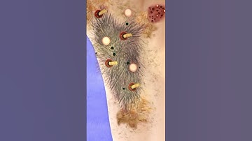 Armpit Magots and Acne Removal | #shorts #ytshorts #viralshorts #short #asmr #geeksandgamers #acne