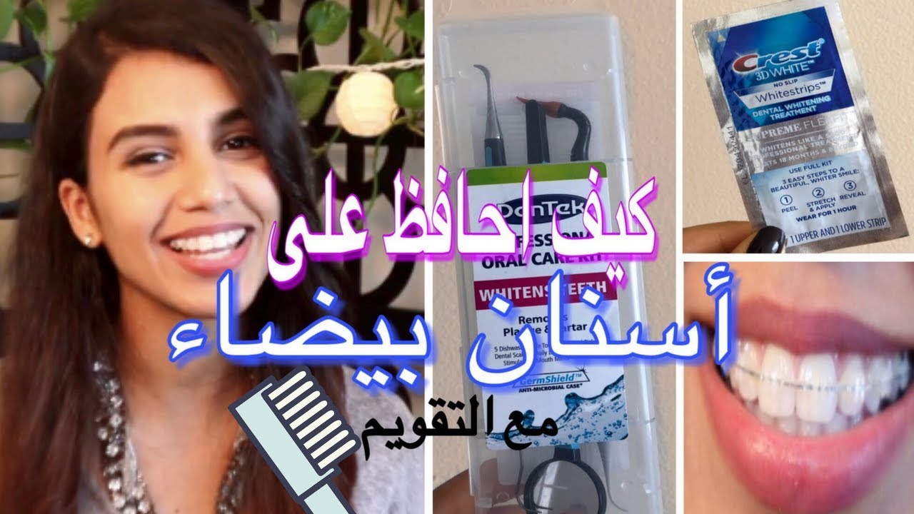 تقويم الاسنان | كيف أحافظ على ابتسامة بيضاء مع  التقويم   ?