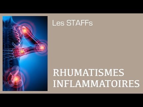 Vidéo: Maladies Rhumatismales: Types, Symptômes Et Causes