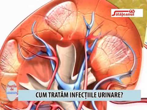 recomandare pentru tratamentul prostatitei adenom de prostată cauza tratamentului prostatitei