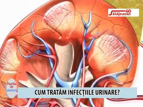 cum tratam infectia urinara