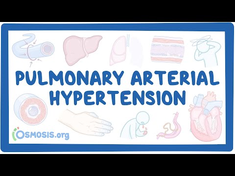 NORD - Pulmonary Arterial Hypertension