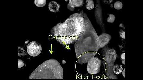 Label-free Live Cell Imaging: T-cells killing cancer cells - zoomed-in