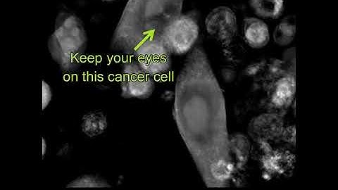 Label-free Live Cell Imaging: T-cells killing cancer cells - zoomed-in