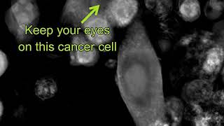Label-free Live Cell Imaging: T-cells killing cancer cells - zoomed-in