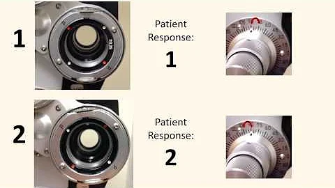 Refracting with a Phoropter: Refining Axis & Cylinder (working in + CYL)