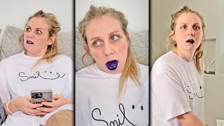 they DYED her teeth!