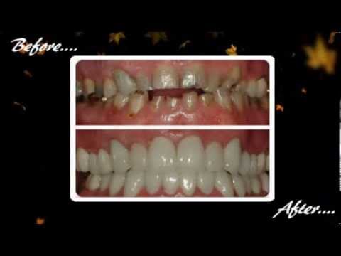 dentist-littleton-|-dr-philip-wimpee-|-the-preferred-dentist-littleton
