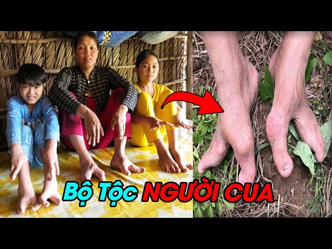 Video Sự Thật Ngã Ngửa Về Bộ Tộc Người Cua Kỳ Lạ Và Quái Dị... - youtube