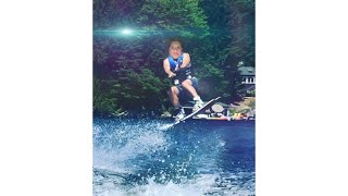 Horrible wakeboarding accident
