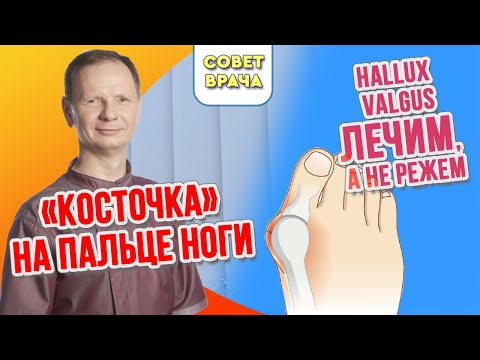 Видео: Hallux Limitus: определение, симптомы, причины и лечение