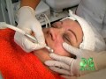 TRATAMIENTOS  FACIALES  PEELING