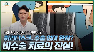 [활기찬클리닉] 🚨 허리 디스크, 꼭 수술해야 할까요? 비수술 치료의 모든 것! 김성덕 원장 | MBC충북 | 250716