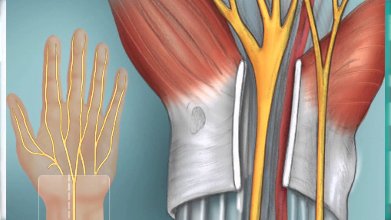 Dr. Tristan Hartzell - Repairing a Cut Flexor Tendon
