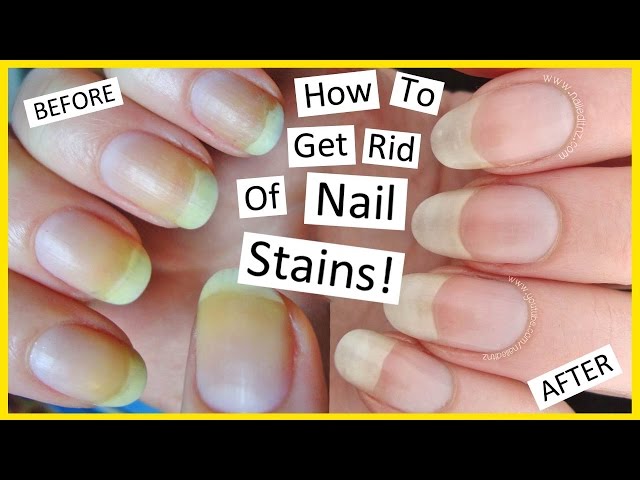 Stained Nails Survival Guide