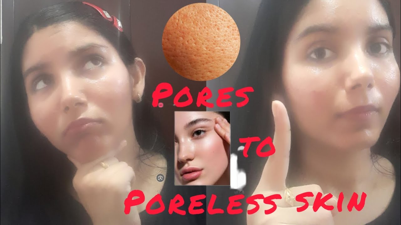 The truth behind open pores and its solution. Dermats