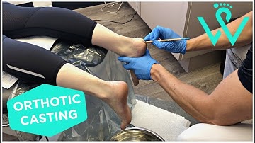 Orthotic Casting