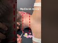 Scrape once, refresh instantly! Post-massage at the hairline —brain clears up right away!