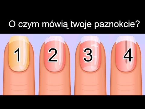 Co paznokcie mówią o Twoim zdrowiu?