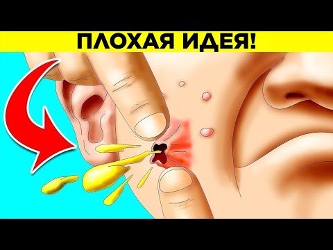 Почему нельзя выдавливать прыщи? Парад Фактов 17