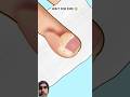 ASMR animation Hand piercing removal treatment P2 #asmr #animation #shortsvideo #trending