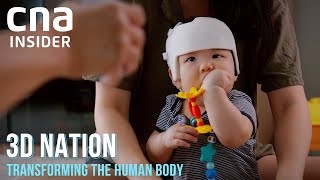 Harnessing 3D Printing To Reshape The Human Body | 3D Nation - Part 7/8 | Full Episode