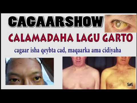 cagaarshow
