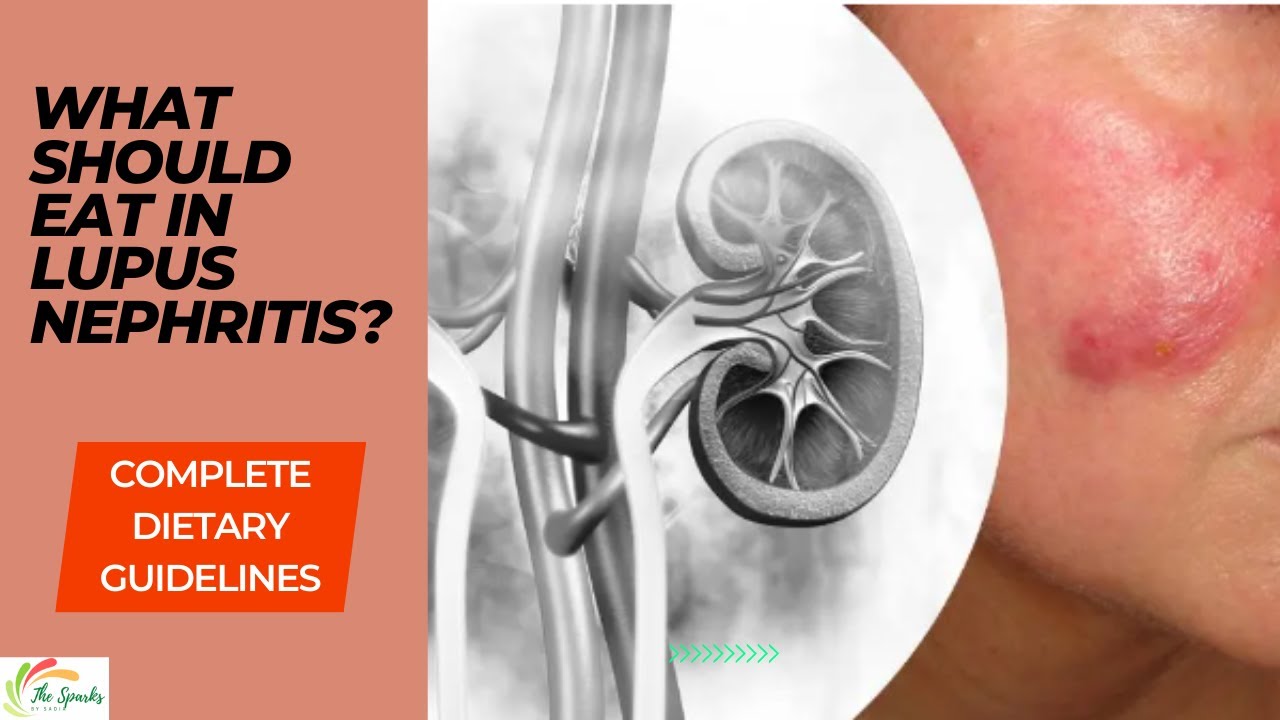 Lupus Nephritis Diet Plan