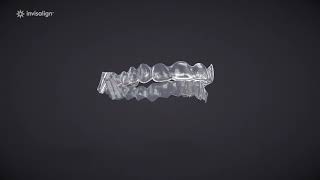 What is Malocclusion? | Invisalign Easton, PA | Rose Dental Center