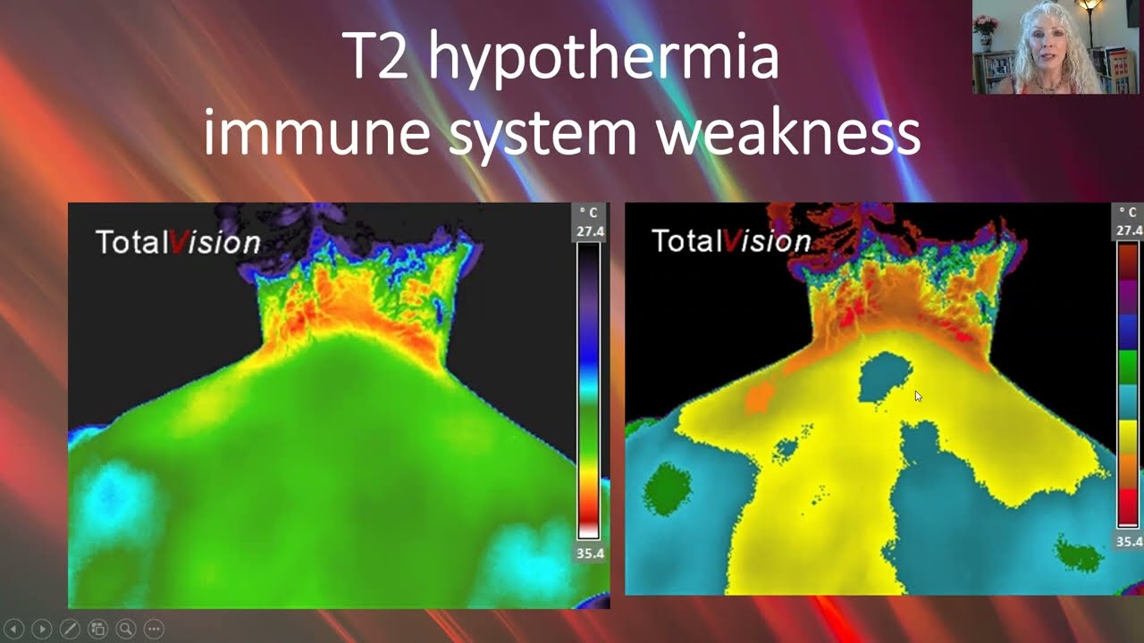Medical Thermography YouTube